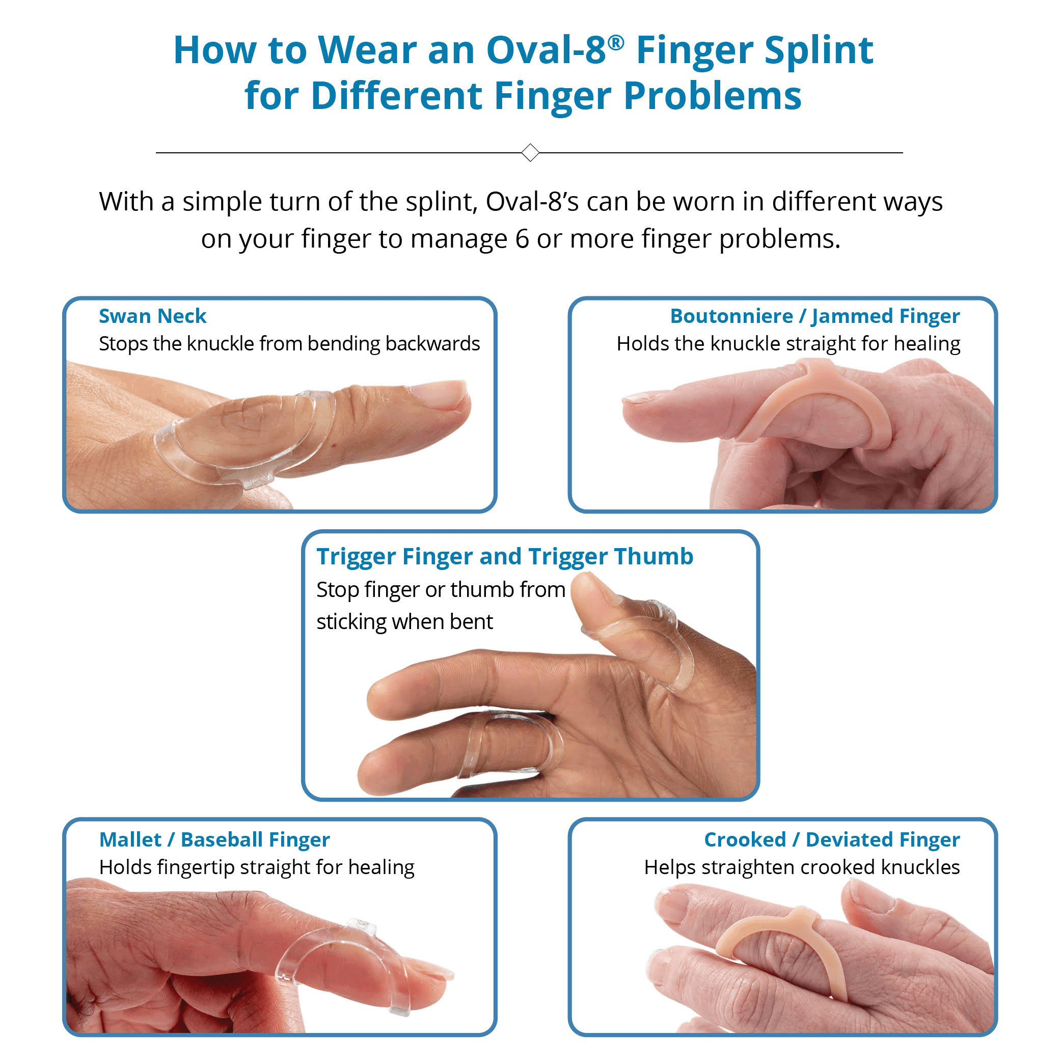 Splint: Types, Uses and How Long To Wear Them