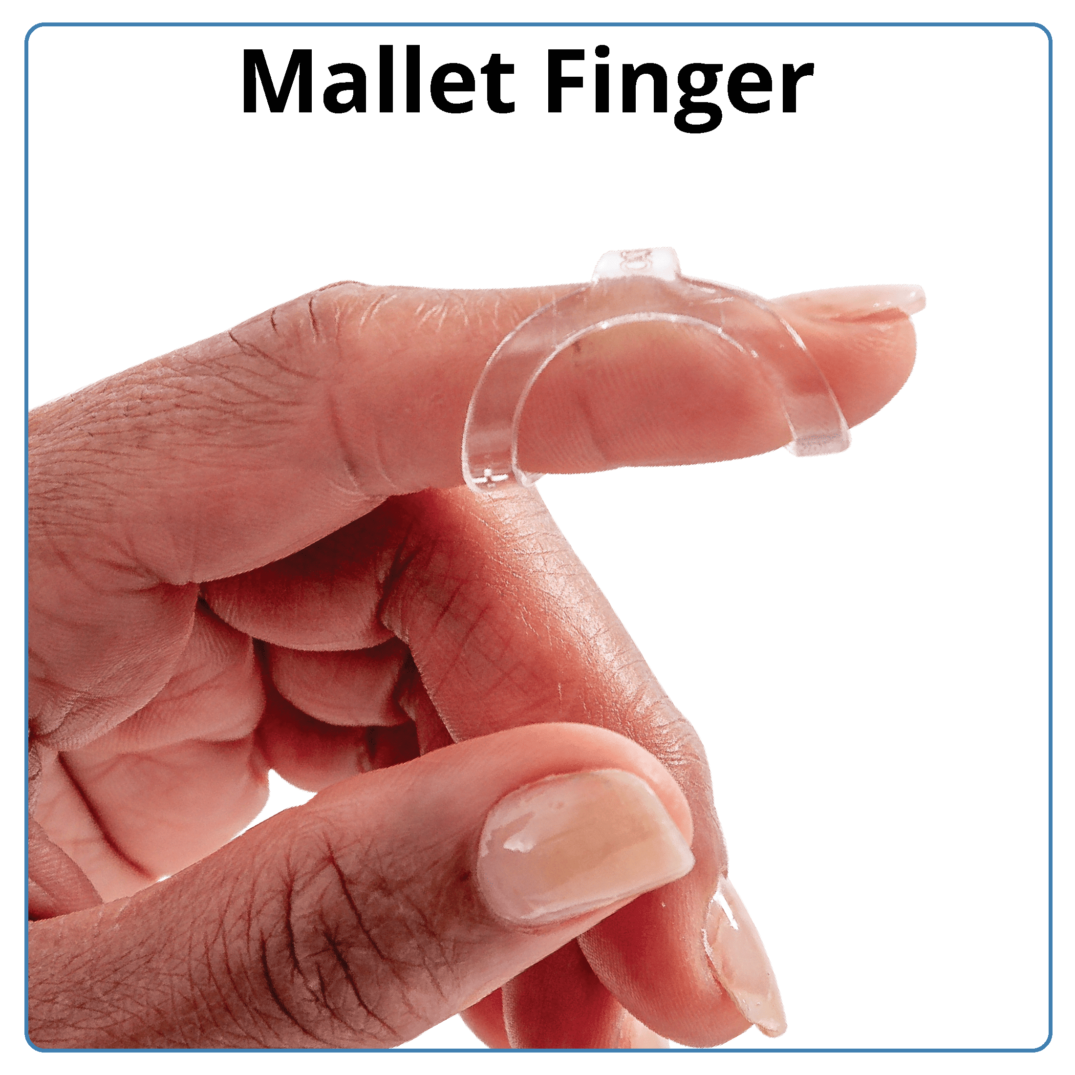 oval-8 finger splint ring splint