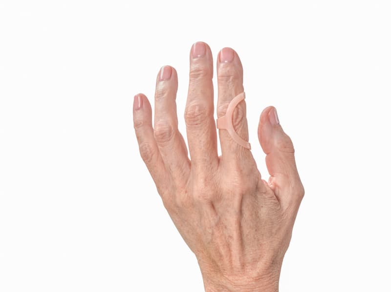oval-8 finger splints for crooked fingers