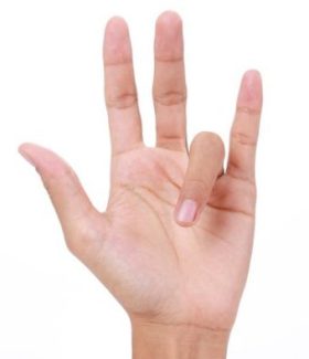 erotisch Bespreken Paradox What Can I Do About My Trigger Finger - Treatment Options