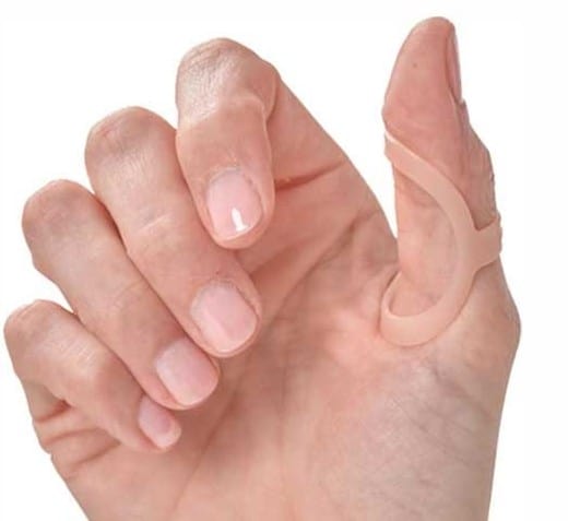 oval-8 finger splint for trigger thumb